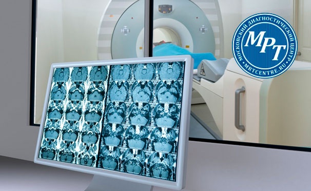Скидка на Магнитно-резонансная томография в медицинском диагностическом центре «МРТ-Центр» со скидкой до 57%
