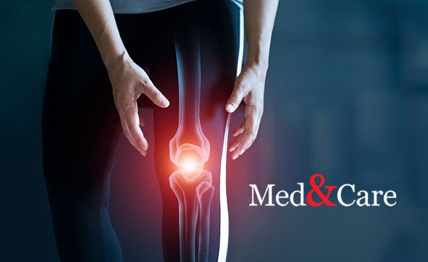 Скидка на Лечение остеоартроза суставов с введением гиалуроновой кислоты в медицинском центре Med & Care. Скидка до 55%
