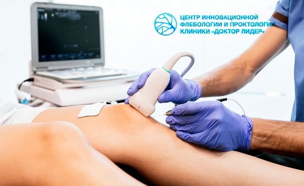 Скидка на Флебологическое обследование и лечение сосудистых звездочек и расширенных вен в центре инновационной флебологии клиники «Доктор Лидер». Скидка до 86%