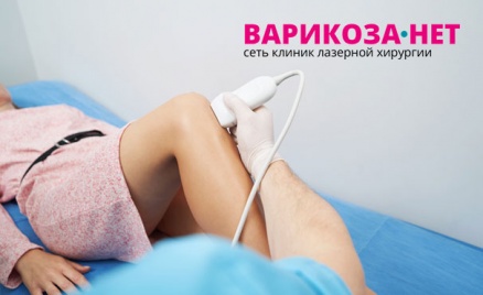 Консультация флеболога и УЗИ вен ног