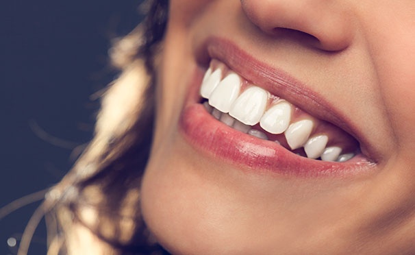 Скидка на Лечение кариеса с установкой пломбы, УЗ-чистка и отбеливание зубов в стоматологической клинике «Амистад». Скидка до 83%