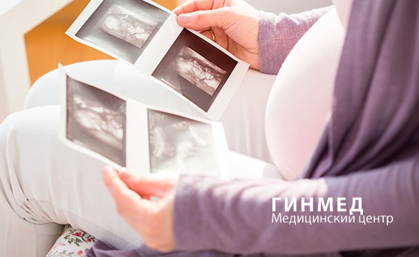 Скидка на Обследование «Буду мамой» в медицинском центре «Гинмед»: консультация гинеколога, УЗИ органов малого таза, мазок на флору, анализы ПЦР и не только. Скидка 80%