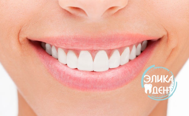 Скидка на Отбеливание зубов Amazing White Extra, лечение кариеса с установкой пломбы, гигиена полости рта в стоматологической клинике «Элика Дент». Скидка до 76%