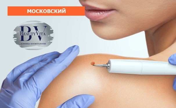 Скидка на Радиоволновое или хирургическое удаление от 1 до 10 новообразований в клинике лазерной медицины и косметологии Beauty Vita. Скидка до 90%