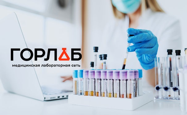 Скидка на Скидка 50% на комплексное исследование крови на выбор в медицинской лаборатории «Горлаб» на «Братиславской»