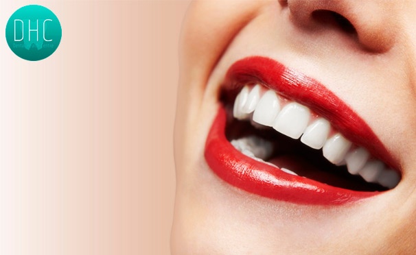 Скидка на Стоматологические услуги в центре Dental Health Centre: отбеливание зубов Air-Flow, УЗ-чистка и покрытие фторлаком, лечение и установка пломбы «под ключ» либо простое удаление зуба. Скидка до 90%