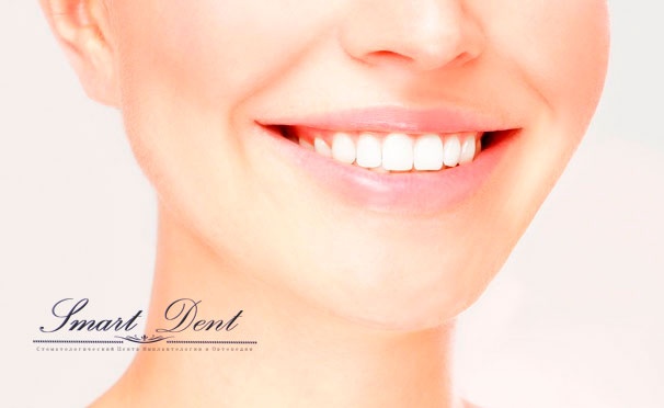 Скидка на Отбеливание и чистка зубов, лечение кариеса, удаление зуба мудрости, установка металлокерамических коронок в клинике Smart Dent. Скидка до 79%