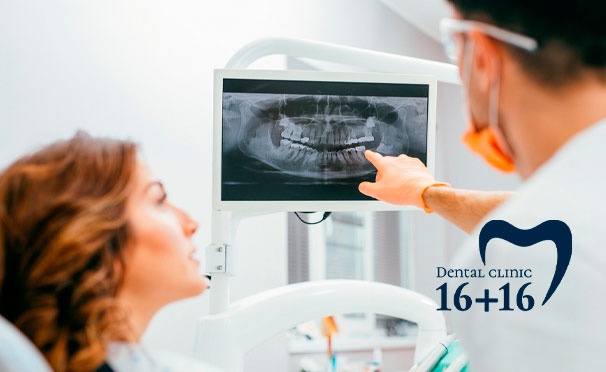Скидка на Компьютерная томография 2 челюстей и профессиональная гигиена полости рта в стоматологической клинике «16+16» со скидкой 50%