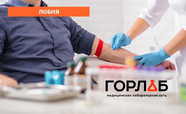 Скидка на Исследование крови в медицинской лаборатории «Горлаб» в Лобне: обследование печени, щитовидной железы, сердечно-сосудистой системы и не только со скидкой 50%