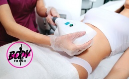 Криолиполиз в студии Body Fresh