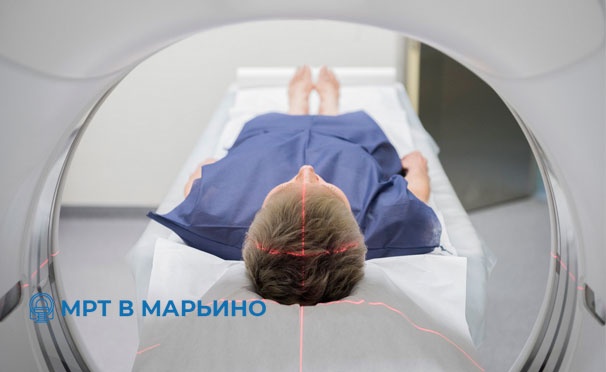 Скидка на Магнитно-резонансная томография головы, позвоночника, суставов и органов, комплексные исследования, прием невролога, кардиолога и терапевта в центре «МРТ в Марьино». Скидка до 57%
