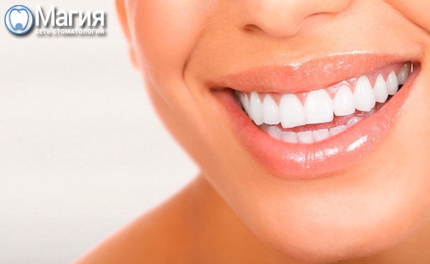 Скидка на Отбеливание зубов Zoom-3 + установка металлических или керамических брекет-систем Roth в стоматологической клинике «Магия». Скидка до 90%