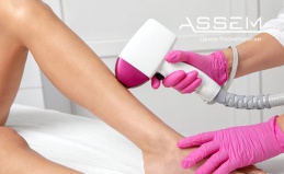 Лазерная эпиляция в центре Assem